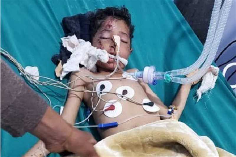 إصابة امرأة وطفلين من أبناء إب في حادث سير بدمت