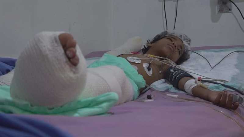 لجنة تحقيق وطنية: تم توثيق مقتل وإصابة نحو 3700 طفل يمني