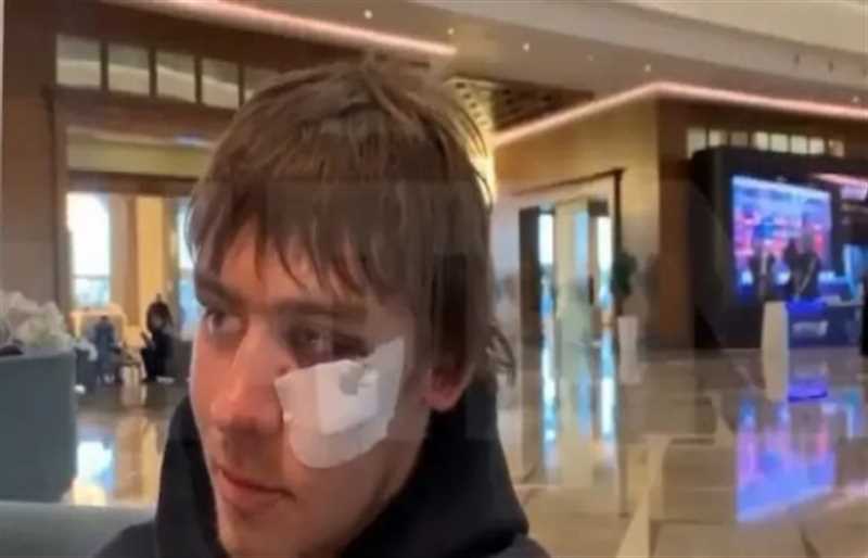 شجار بين فريق روسي وآخر أوكراني داخل فندق في تركيا