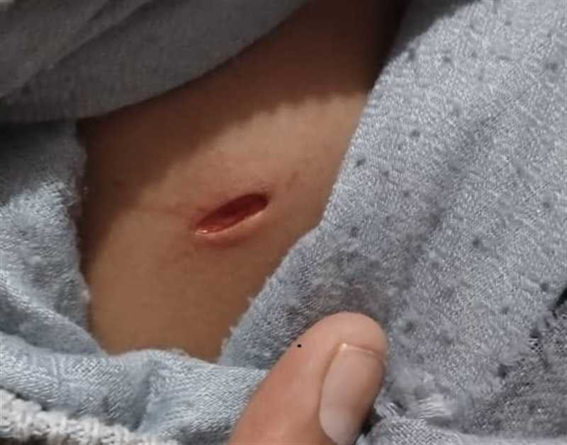 إصابة طفل برصاص راجع في مدينة جبلة