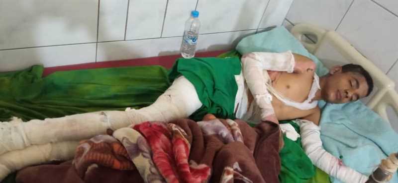 مقتل طفل وإصابة شقيقه في قصف حوثي شمال مدينة تعز