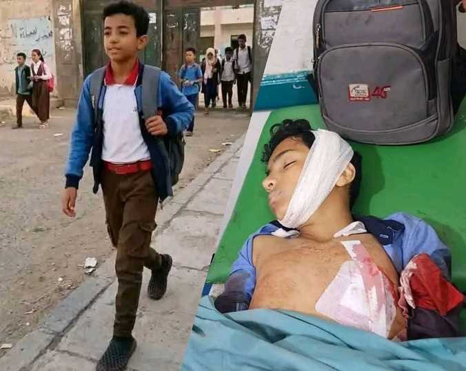 منظمة حقوقية: قنص المدنيين في تعز جريمة حرب مكتملة الأركان