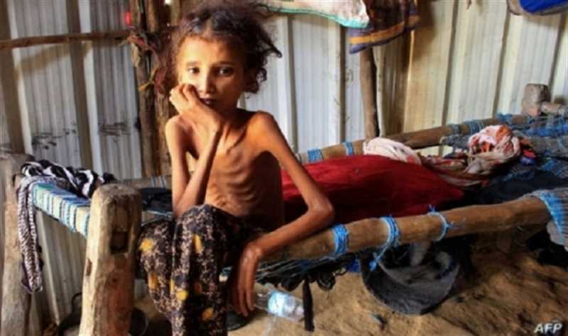 تقرير دولي: اليمن أكثر بلد فقراً في العالم 
