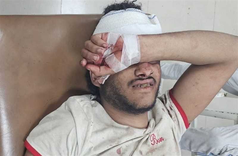 تعز..إصابة شاب وطفل بنيران وألغام مليشيا الحوثي ‫