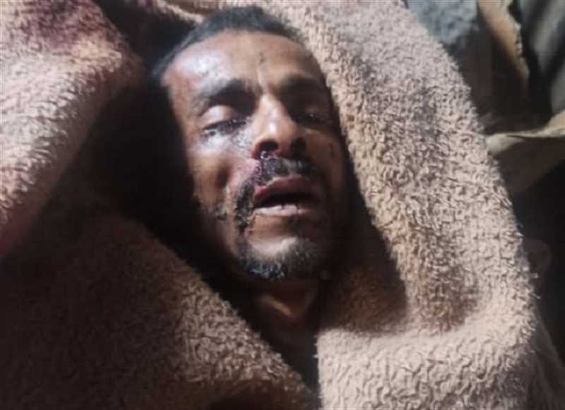 وفاة مواطن في حادثة سقوط من على منزله جنوبي إب