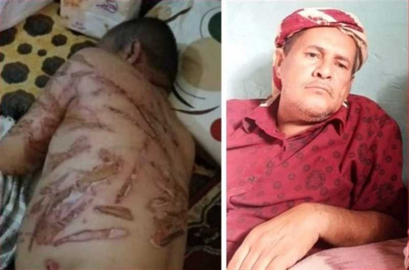 "جريمة بشعة وانتهاك صارخ".. غضب يمني واسع عقب وفاة أحد أبناء إب تحت التعذيب في سجون الانتقالي