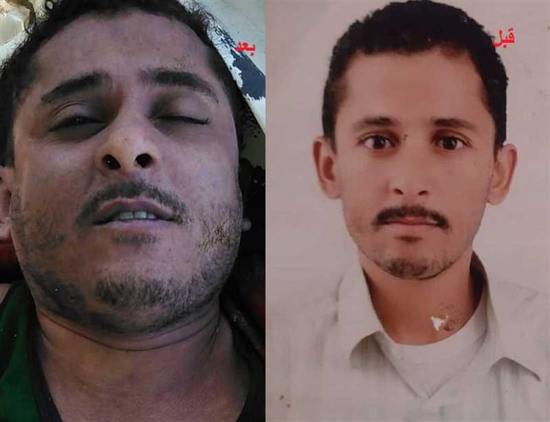 الحكومة تندد بوفاة مختطف في سجن مليشيا الحوثي بصنعاء
