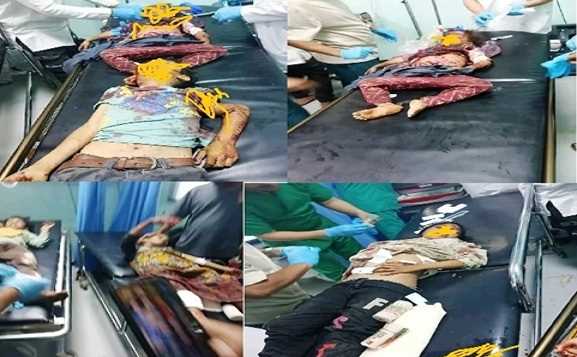 وزارة حقوق الإنسان تدين الجريمة الحوثية البشعة الإرهابية بحق أطفال قرية الريبي بمحافظة الضالع