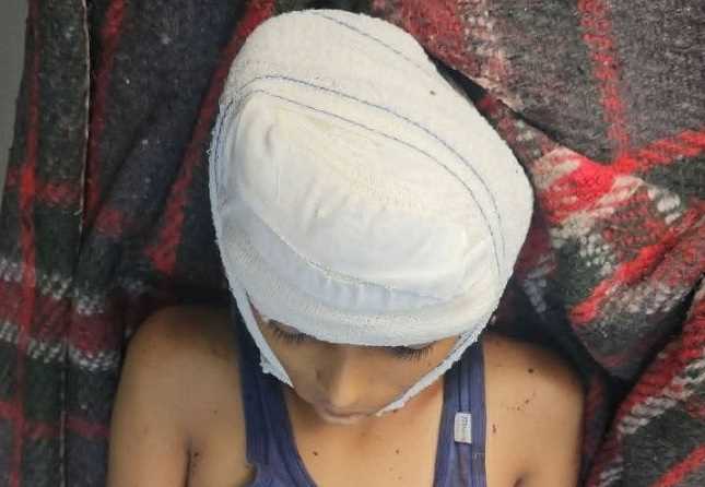 استشهاد طفل وإصابة امرأة بشظايا قذيفة أطلقها الحوثيون على حي سكني شرقي تعز