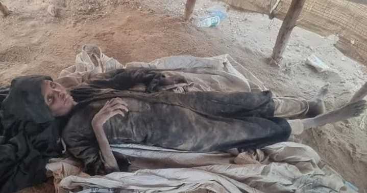 مسؤول حكومي: مليشيات الحوثي مسؤولة عن أوضاع النازحين في حجة