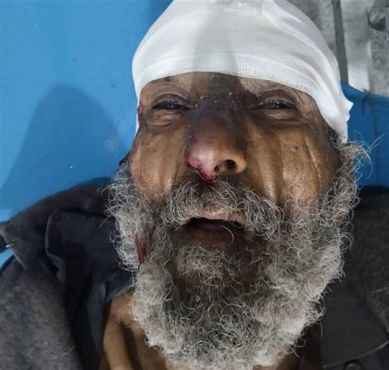 وفاة مسن مجهول الهوية في حادثة سير شمالي إب