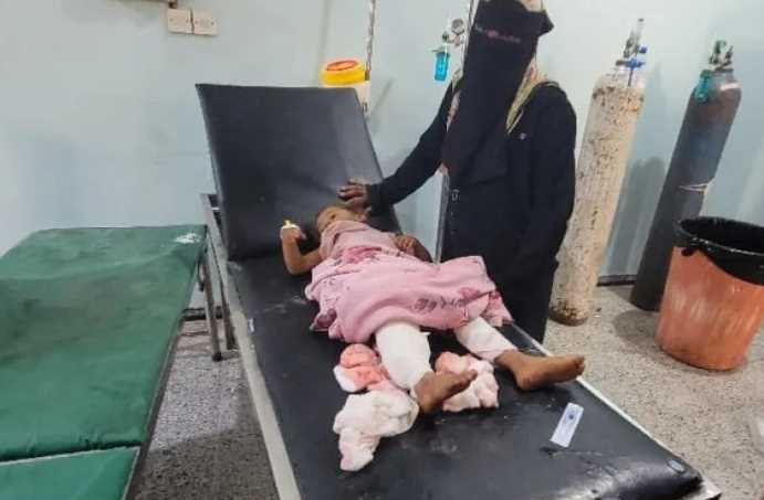 إصابة امرأة وثلاثة أطفال بقصف حوثي في الحديدة والضالع