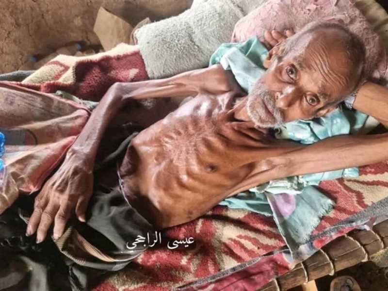 حجة.. وفاة مُسن جراء الجوع في أحد مخيمات النازحين بعبس