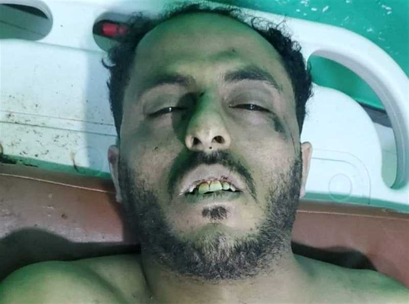 وفاة مواطن من إب في حادث مروري بصنعاء