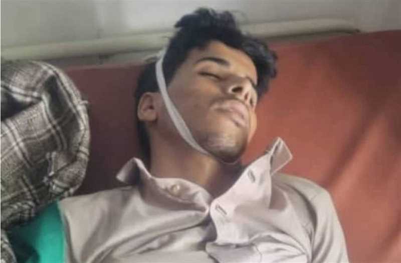 شبكة حقوقية: وفاة شاب بعد ساعتين من احتجازه في معتقل حوثي بحجة