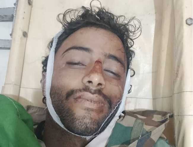 وفاة سائق دراجة نارية في حادثة سير جنوبي إب