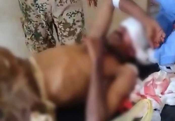 إصابة مدني بقصف حوثي استهدف تجمع سكاني غربي تعز
