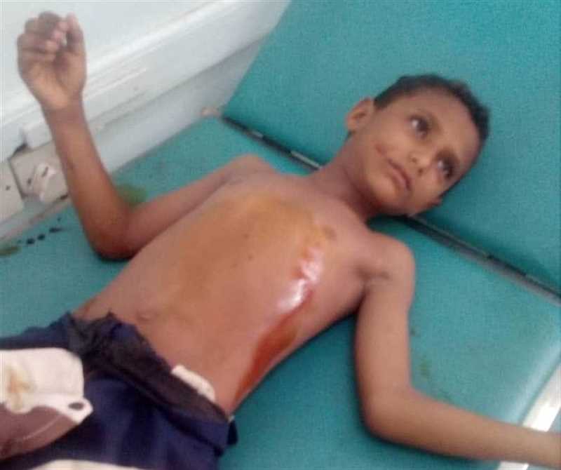 شهية مفتوحة للدم.. مقتل وإصابة 15 طفلاً بألغام وقذائف الحوثيين خلال يومين